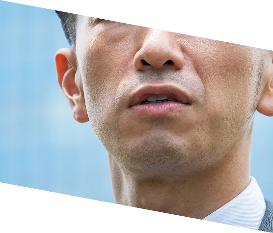 顔全体のシワ・凹み・たるみ