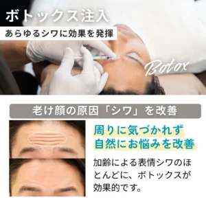 ボトックス注入キャンペーン